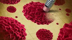 Czynniki, które zwiększają ryzyko nowotworu. Większość możesz wyeliminować