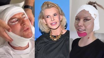 Joanna Racewicz o modzie na medycynę estetyczną: "Sama to na własnym ciele PRZEĆWICZYŁAM"