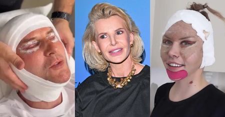 Joanna Racewicz o modzie na medycynę estetyczną: "Sama to na własnym ciele PRZEĆWICZYŁAM"