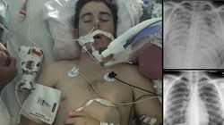 E-papierosy mogą powodować śmierć i choroby płuc. Sześć osób nie żyje, kilkaset w szpitalach