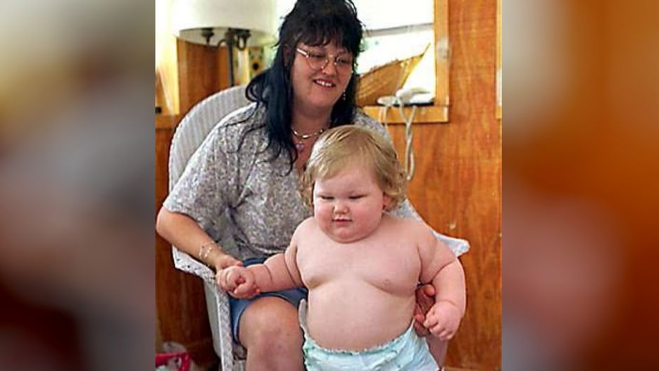 Ważył 31 kg, gdy miał zaledwie 17 miesiący. Jak dziś wygląda "gigantyczne dziecko"?