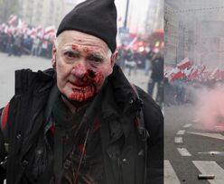 74-letni fotoreporter "Tygodnika Solidarność" POSTRZELONY gumową kulą na Marszu Niepodległości. Policja: "Jest nam PRZYKRO"