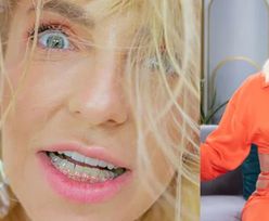 Anna Wyszkoni w aparacie ortodontycznym reaguje na komentarze dotyczące odmienionego wyglądu: "Ja i moja NOWA TWARZ..." (FOTO)