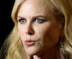 Internauci krytykują okładkę "Vanity Fair" z Nicole Kidman: "LEDWO SIEBIE PRZYPOMINA!" (FOTO)