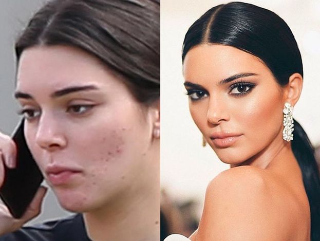 Kendal Jenner twarzą kosmetyków na trądzik. Fani: "Chyba sobie żartujesz! To żałosny płacz dla odrobiny uwagi"
