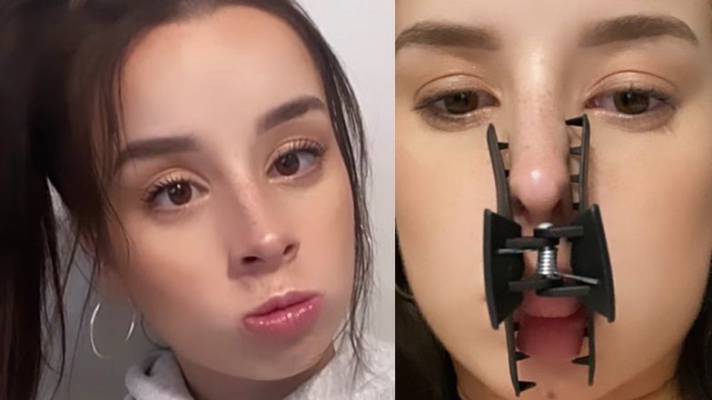 Zakażona koronawirusem Sylwia Lipka pokazuje zdjęcia ze spinką na nosie i ustach. "NEVER ENDING STORY"