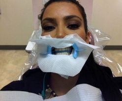Kim Kardashian u dentysty!