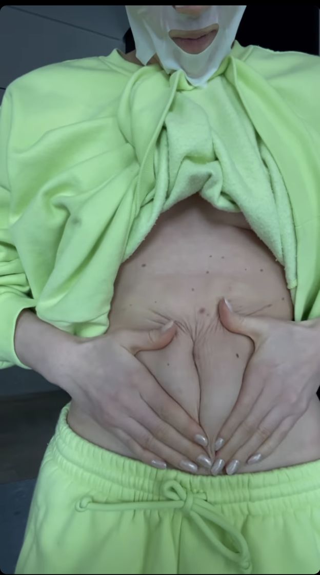 Ciałopozytywna Maffashion pokazuje skórę po ciąży: "Rozciągnięta, pomarszczona, normalna" (FOTO)