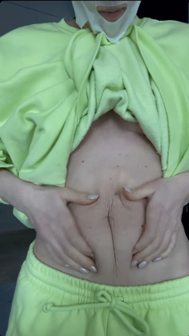 Ciałopozytywna Maffashion pokazuje skórę po ciąży: "Rozciągnięta, pomarszczona, normalna" (FOTO)