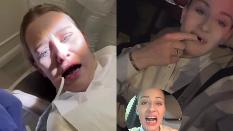 Drama Andziaks.  Youtuber lost a tooth: “I bit my fork with all my strength and I shot something” (PHOTO)