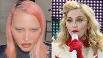 Madonna znów SZOKUJE drastyczną metamorfozą. Fani są przerażeni: "CO TY SOBIE ZROBIŁAŚ?!"