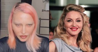 Chirurg gwiazd wymienia, jakimi zabiegami Madonna OSZPECIŁA swoją twarz w ostatnim czasie. Trochę tego było...
