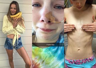 15-letnia modelka pokonała anoreksję. "Groziło mi, że serce mi się zatrzyma. Byłam karmiona przez sondę"