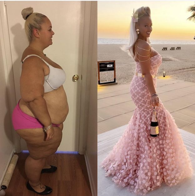 Nie mieściła się w fotelu samolotowym. Zrzuciła 90 kg i upodobniła się do lalki Barbie: "Jestem inspiracją"