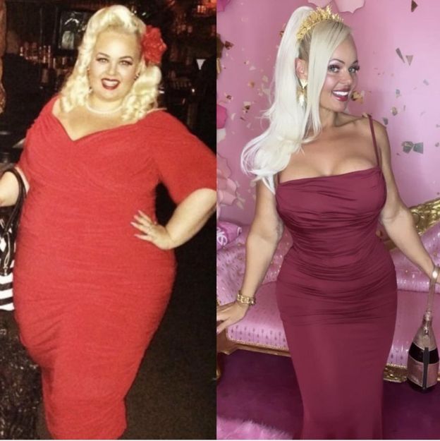 Nie mieściła się w fotelu samolotowym. Zrzuciła 90 kg i upodobniła się do lalki Barbie: "Jestem inspiracją"