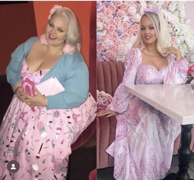 Nie mieściła się w fotelu samolotowym. Zrzuciła 90 kg i upodobniła się do lalki Barbie: "Jestem inspiracją"