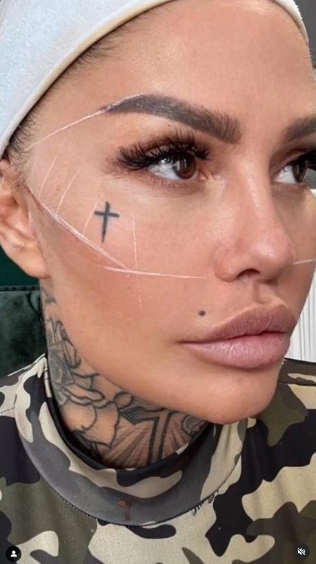 Laluna Unique chwali się KOLEJNYM zabiegiem na twarz i pieje z zachwytu: "Jestem zachwycona!" (FOTO)