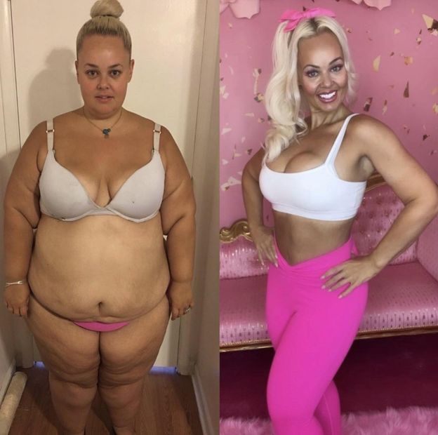 Nie mieściła się w fotelu samolotowym. Zrzuciła 90 kg i upodobniła się do lalki Barbie: "Jestem inspiracją"