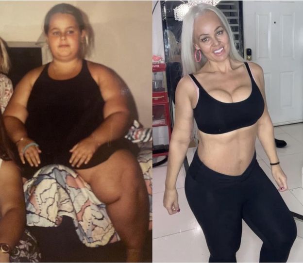 Nie mieściła się w fotelu samolotowym. Zrzuciła 90 kg i upodobniła się do lalki Barbie: "Jestem inspiracją"