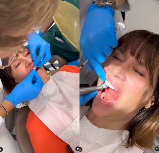Grażyna Wolszczak chwali się NOWYMI ZĘBAMI: "Jakie piękne!" (FOTO)