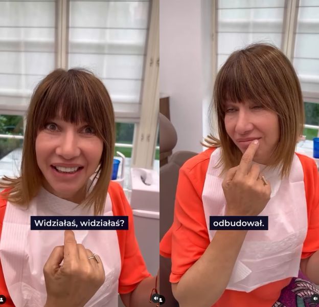 Grażyna Wolszczak chwali się NOWYMI ZĘBAMI: "Jakie piękne!" (FOTO)