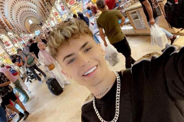 Aspirujący model zrobił sobie zęby w Turcji. Teraz żałuje. "Wyglądam jak rekin" (FOTO)