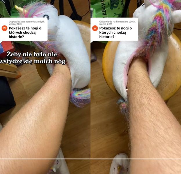 Tiktokerka od dwóch lat NIE GOLI NÓG. Opowiedziała o przykrej sytuacji w PKP: "Z takimi włosami do ludzi?!" (FOTO)