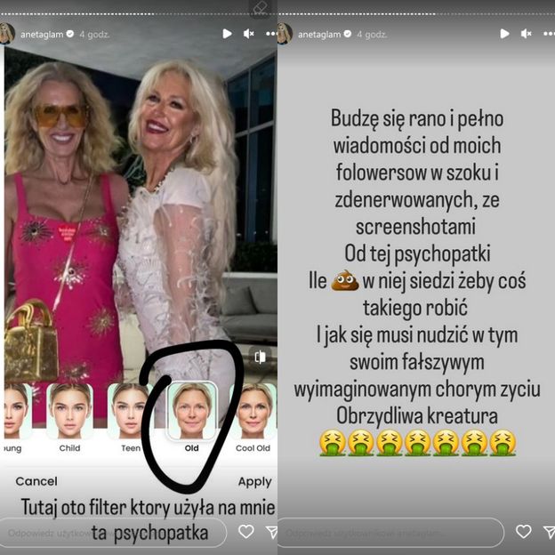 Caroline Derpienski kpi z Anety Glam, publikując wspólne zdjęcie. "Żona Miami" twierdzi, że została POSTARZONA specjalnym filtrem