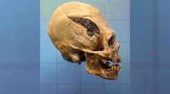Wydłużona czaszka z metalową płytką sprzed 2 tys. lat. Niezwykłe odkrycie z Peru