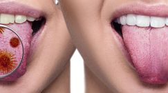 Zła higiena jamy ustnej może przyczynić się do raka trzustki