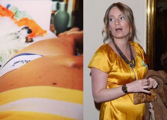 Śródka: "Kobiety w ciąży stają się ODMÓŻDŻONE"