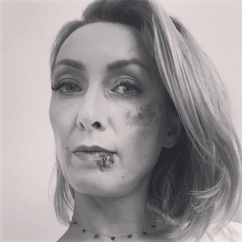 Anna Kalczyńska z waznym apelem do kobiet