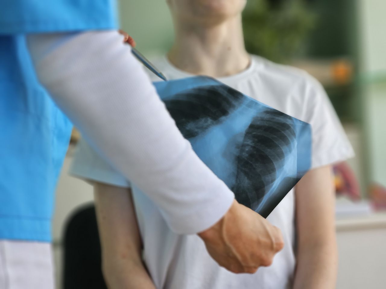 Nauczycielka z gruźlicą w mrągowskiej szkole. Do diagnozy m.in. uczniowie