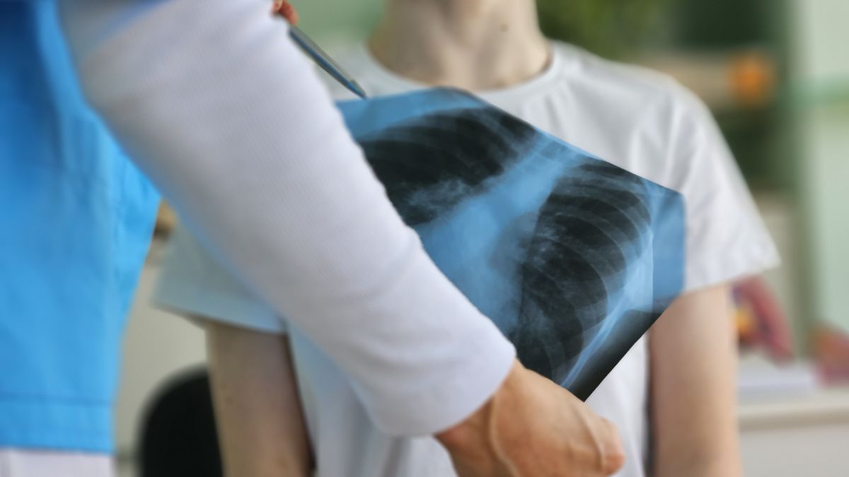 Nauczycielka z gruźlicą. Narażeni m.in. uczniowie