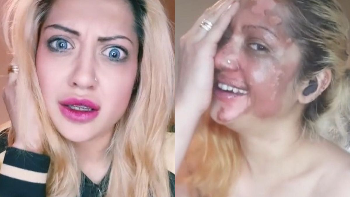 Tragiczny wypadek oszpecił jej twarz. 