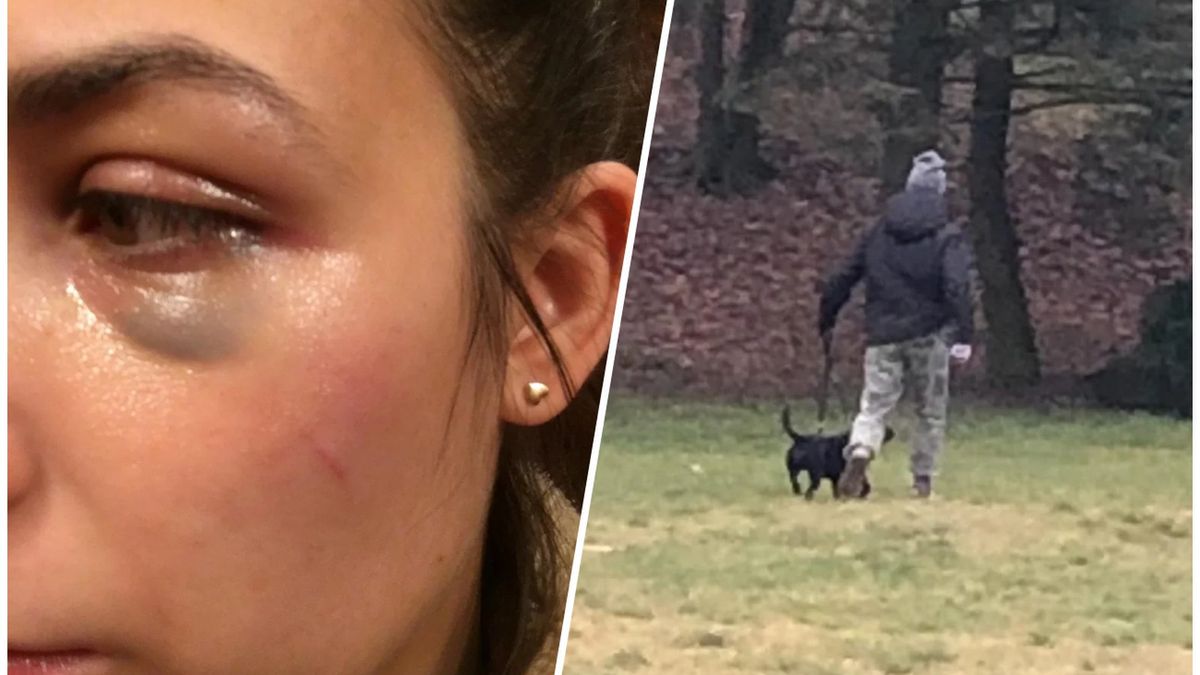 Czy to raper pobił młodą kobietę?