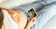 ZUS szykuje poradnik dla kobiet w ciąży i uruchamia specjalną skrzynkę mailową