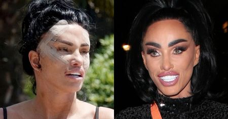 Tak Katie Price wyglądała PRZED OPERACJAMI, na które wydała ponad milion złotych. Były jej potrzebne?