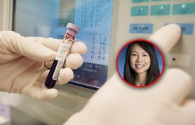 Tak "zdradza się" rak. Nowe badanie krwi pomoże wykryć nowotwór nawet trzy lata przed diagnozą