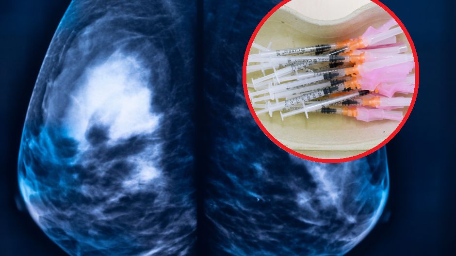 To może być przełom w leczeniu raka piersi. Obiecujące wyniki badań nad szczepionką