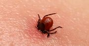 Sezon na kleszcze rozpoczęty. Jak się przed nimi chronić?