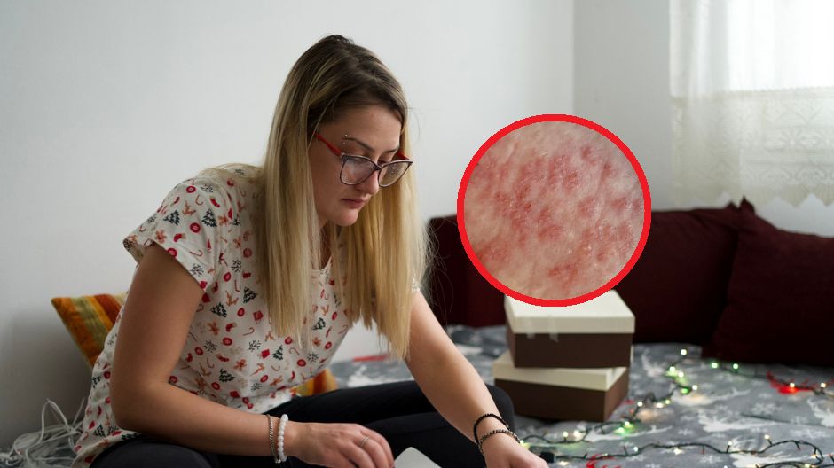 Niepokojące objawy, które zauważysz podczas pakowania prezentów. Mogą wskazywać nawet na raka