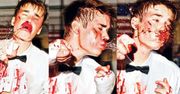 ZAKRWAWIONY, POBITY Justin Bieber! (ZDJĘCIA)