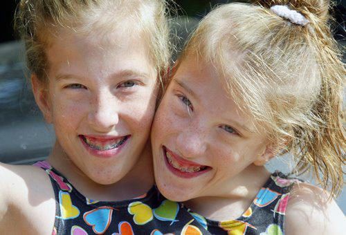Abby i Brittany w dzieciństwie