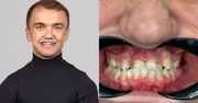 Mini Majk zaskoczył metamorfozą. Pokazał swój nowy uśmiech