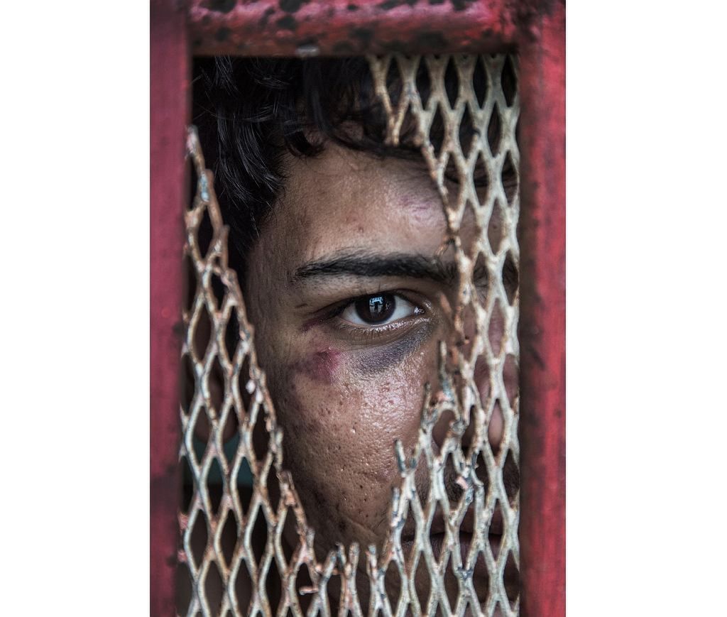 Nagroda za zdjęcie portretowe powędrowała do** Briana Casseya z News Corp Australia**, który uwiecznił pobitego uchodźcę.