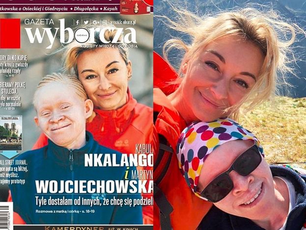 Wojciechowska pozuje z adoptowaną córką na okładce: "Maczetą odrąbali mi rękę. Ciało albinosa warte jest 75 TYSIĘCY dolarów"