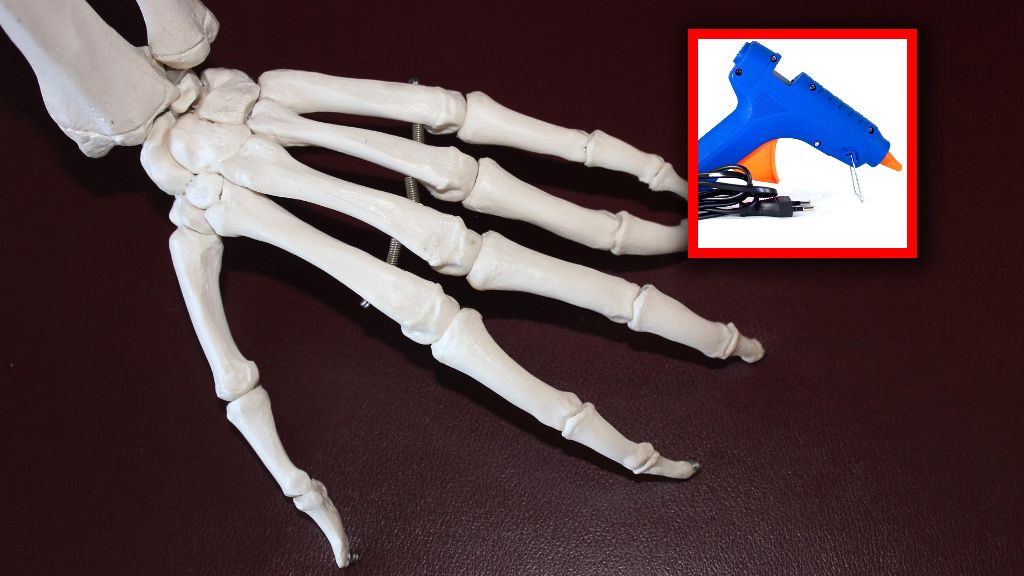 Kości mogą być "naprawiane" przy pomocy specjalnej substancji