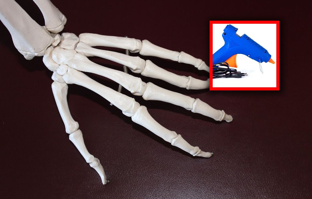 Lepsze przeszczepy kości? "Drukowanie" bezpośrednio na złamanie