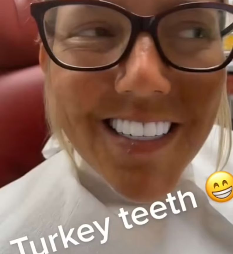 Efekt nie zachwycił 35-latki